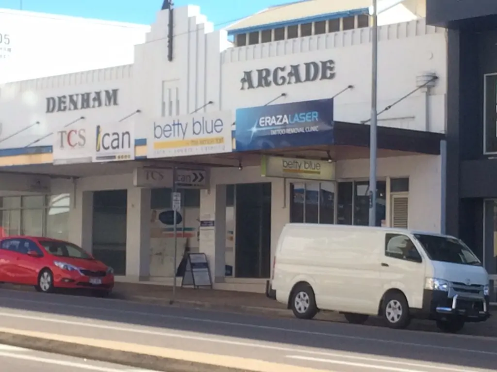 Laser Tattoo Removal Townsville