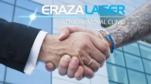 tattoo removal career